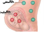 تزریق آمپول روگام- آمپول روگام در بارداری